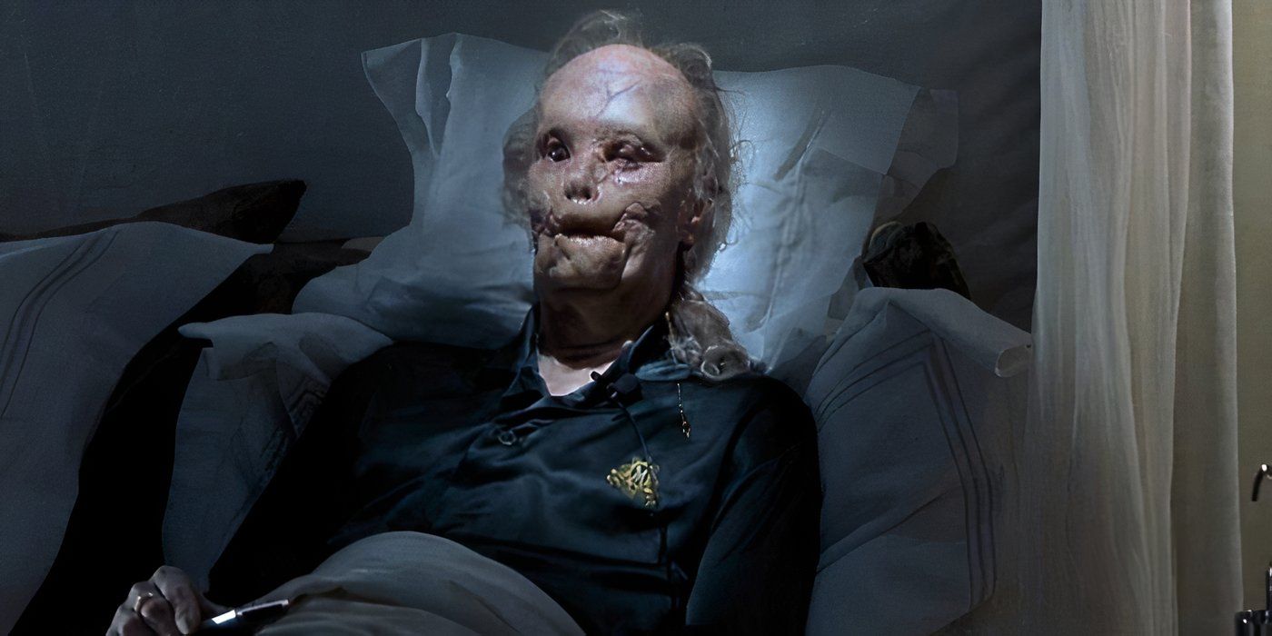 Hannibal (2001) Gary Oldman as Mason Verger sitting in a bed with horrible injuries/ disfigurements on his face