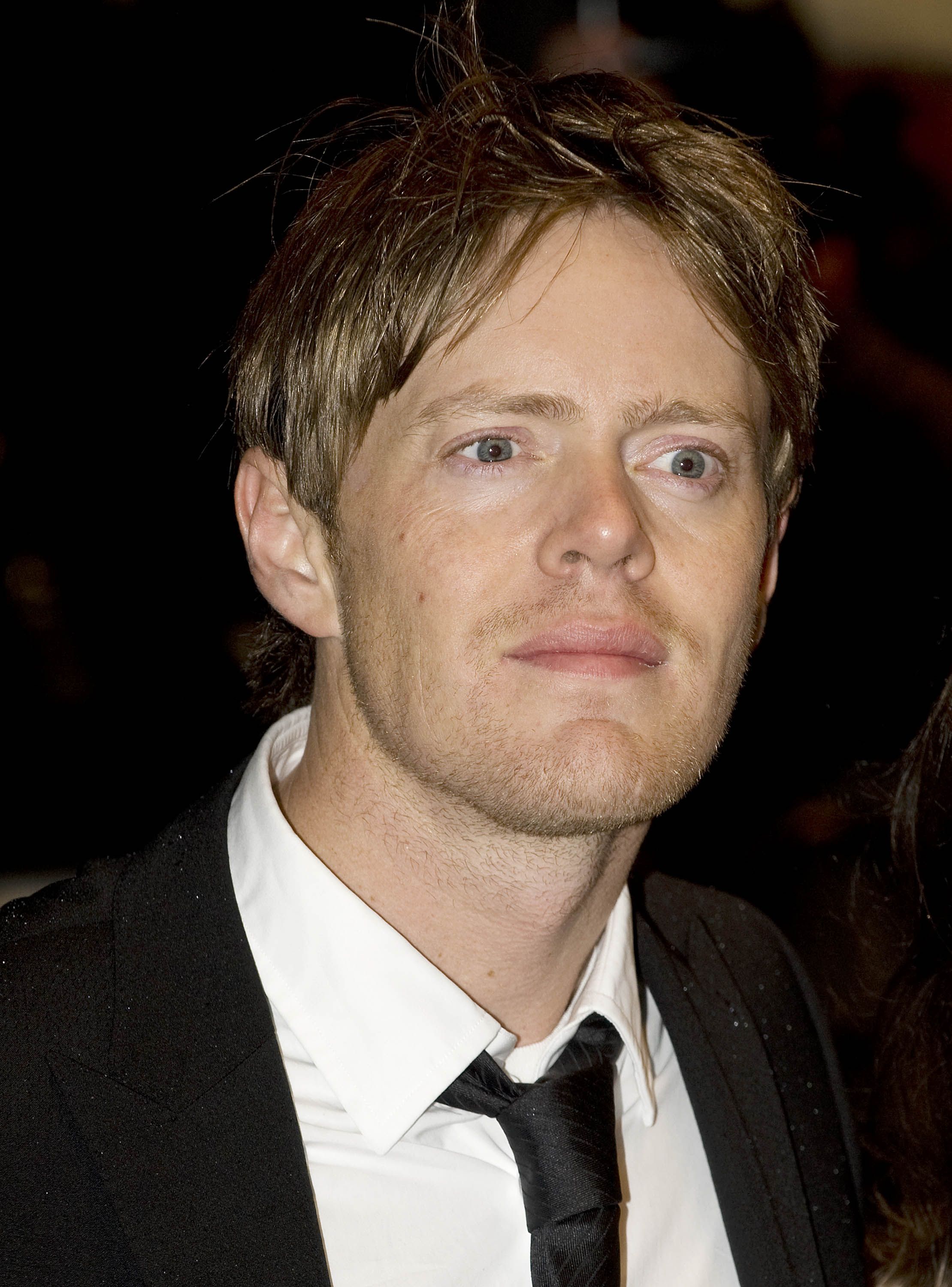 Kris Marshall Face Surgery - Public Discussion