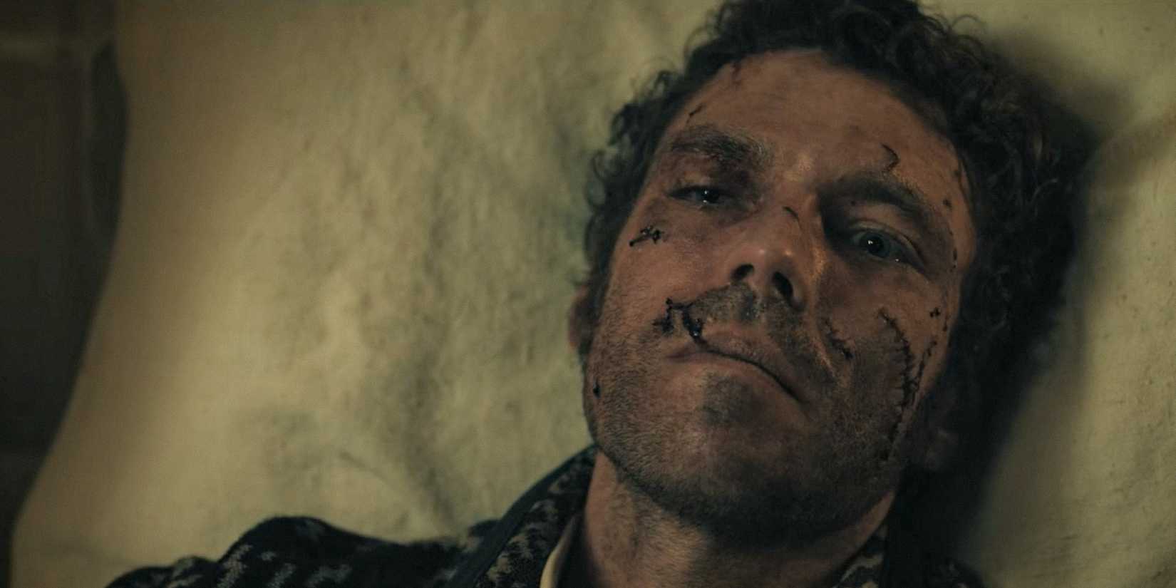 Edward 'Treacle' Goodson (James Nelson-Joyce) with multiple scars on his face in A Thousand Blows Season 1 Ep 6