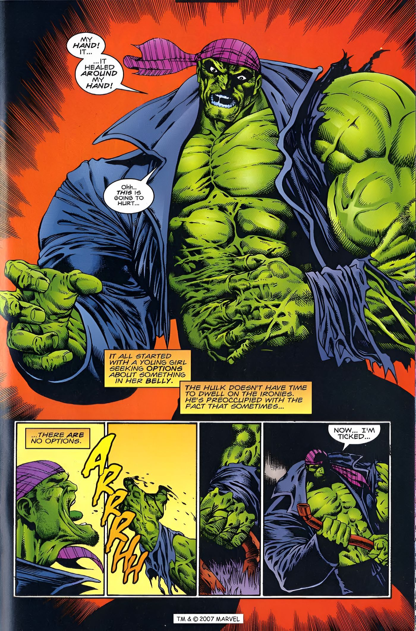The Hulk&rsquo;s hand is fused to his torso, but the Hulk rips it off.