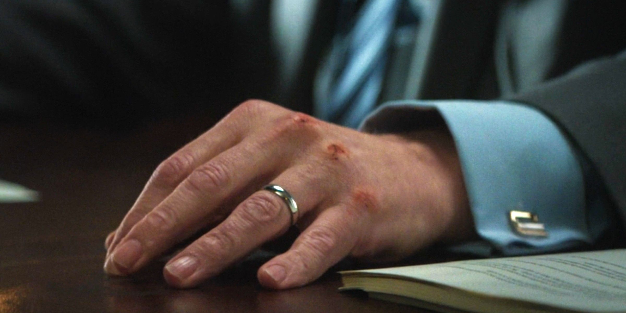 Wilson Fisk Bloodied Knuckles in Daredevil Born Again