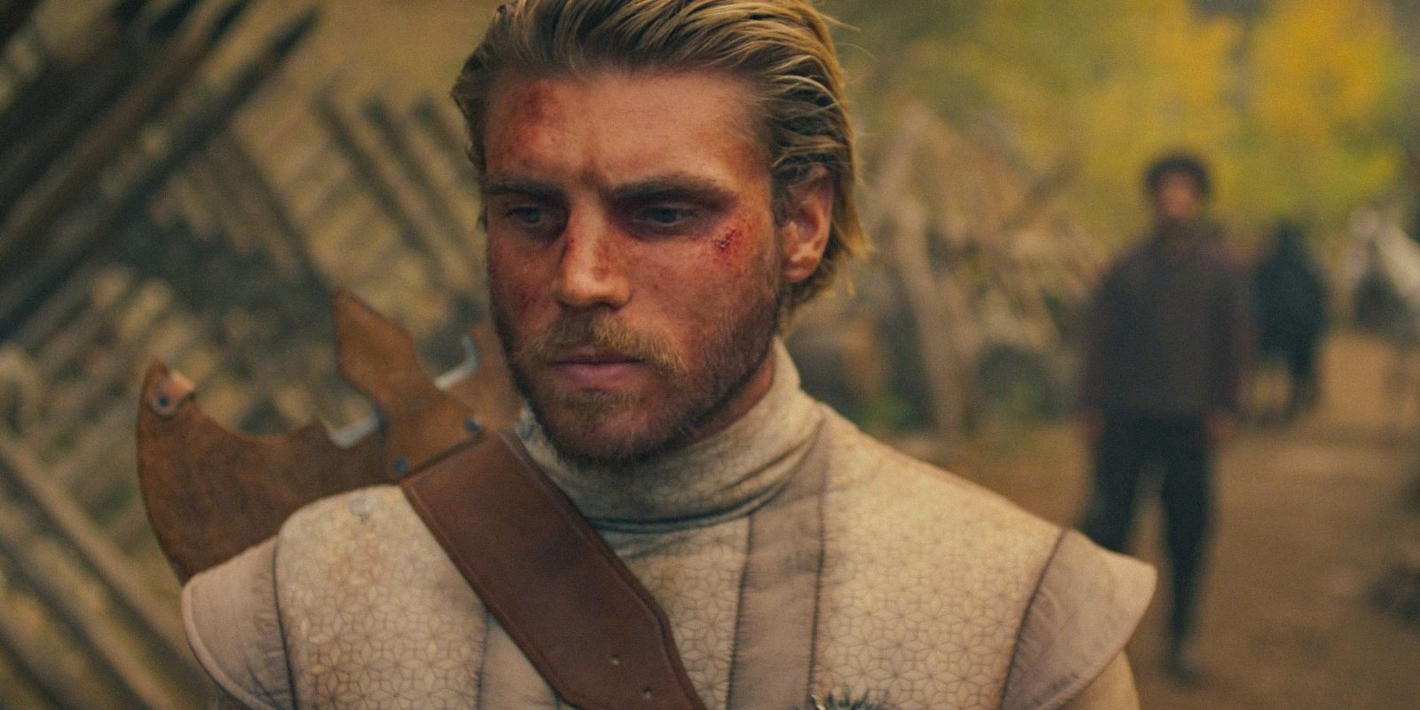 Lord Luc (Michael Lindall) with injuries on his face in The Wheel of Time Season 3 Ep 7