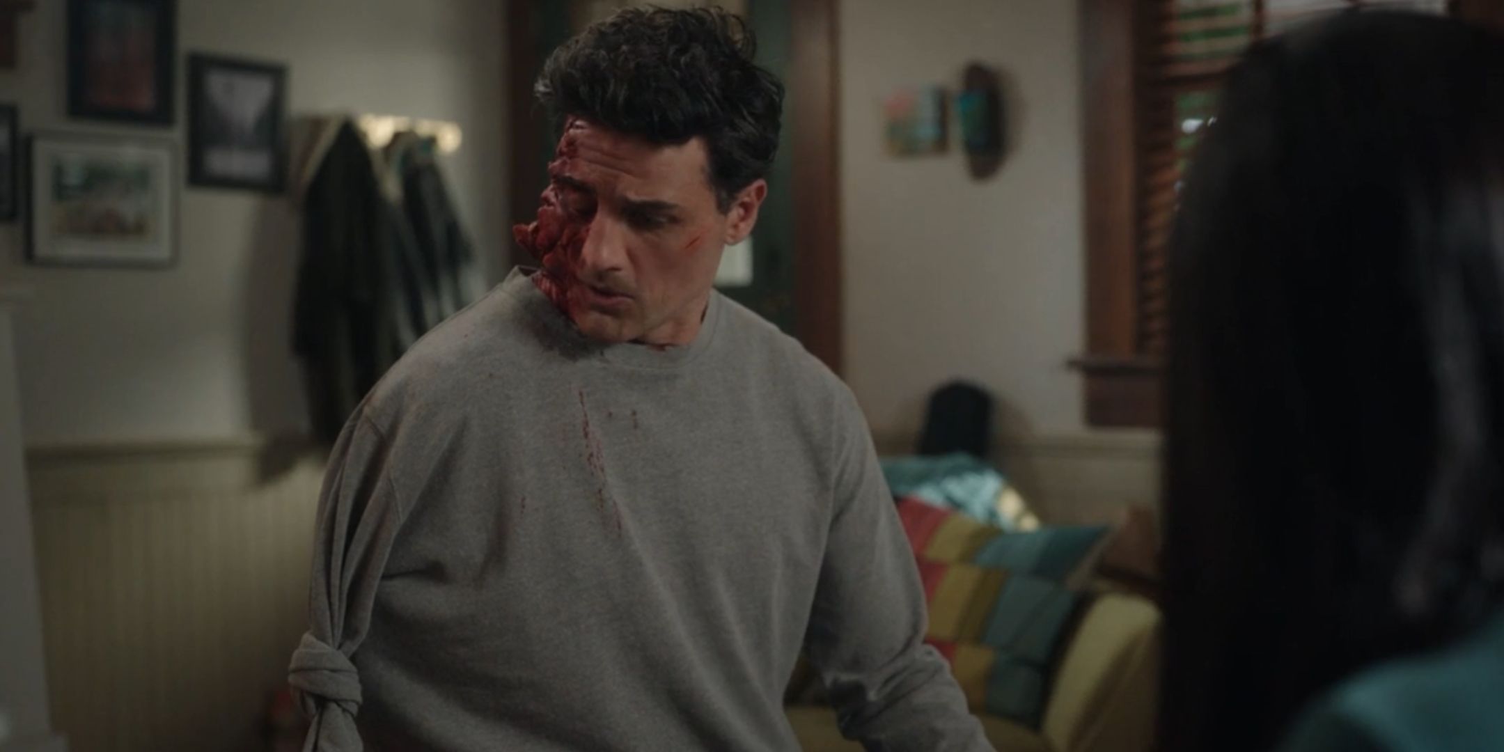 Enver Gjokaj as Joseph in Resident Alien with severe facial injuries