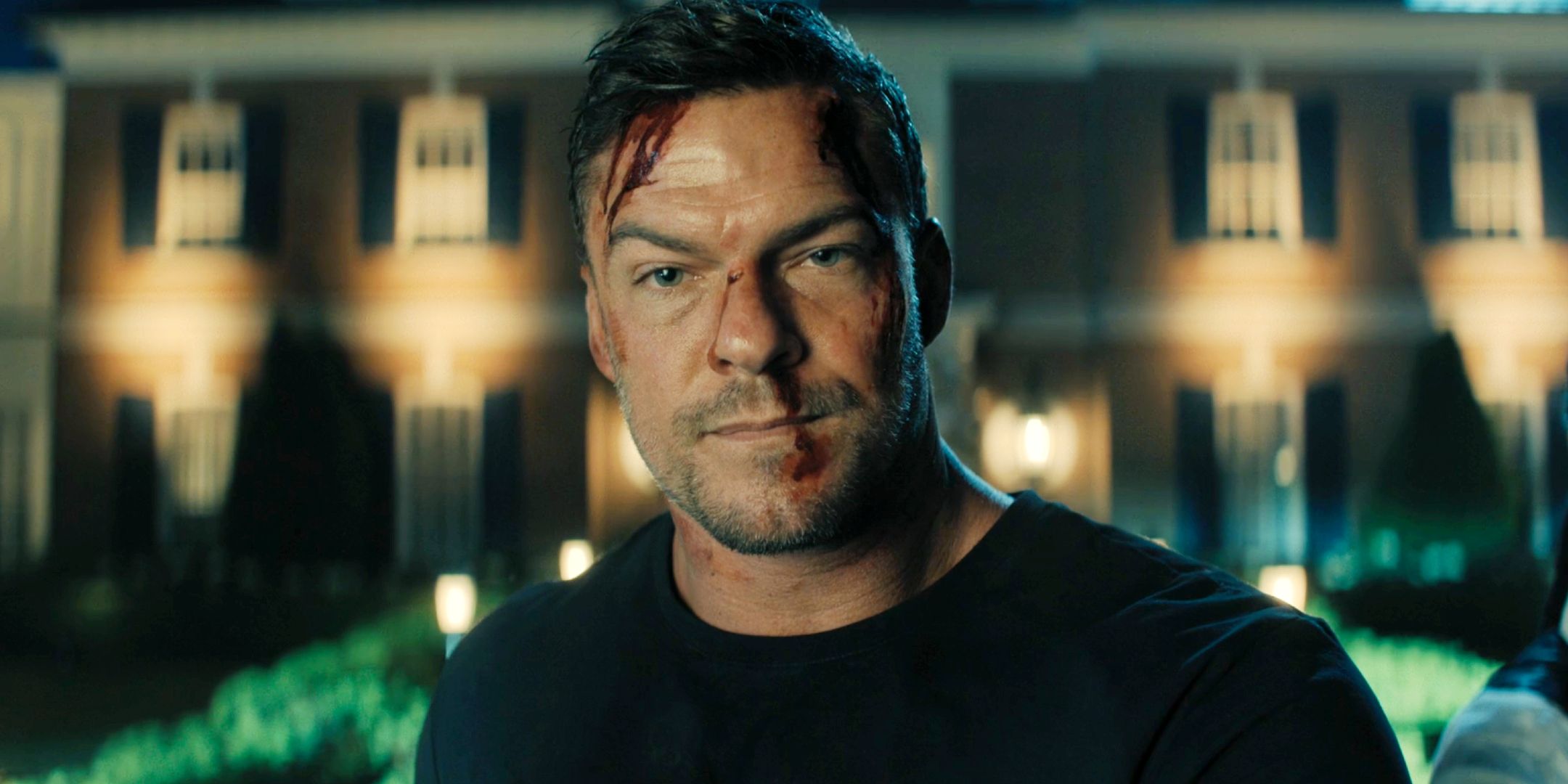 Alan Ritchson with cuts on his face in Reacher season 3