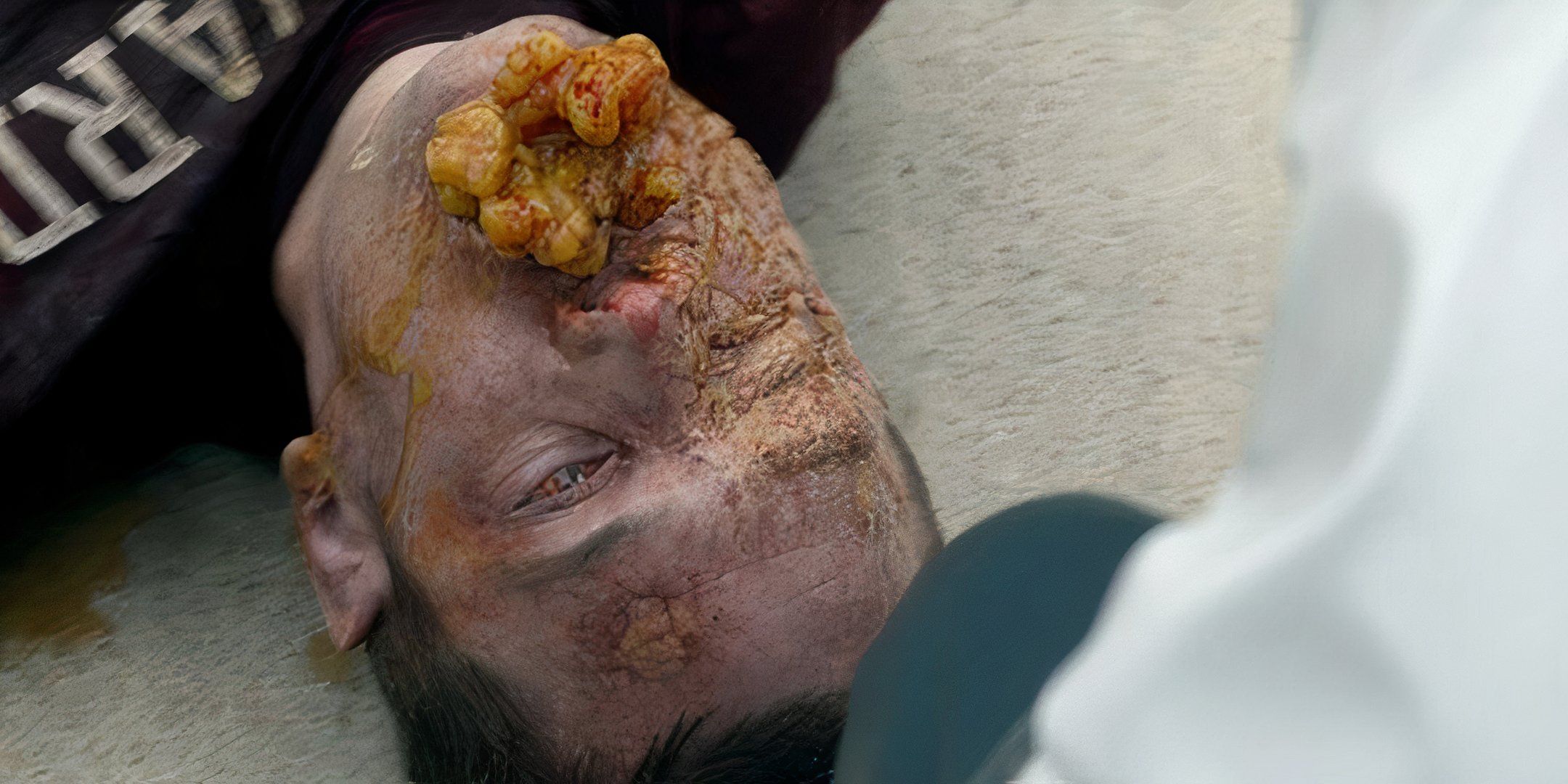 An infected man in the TV show Helix