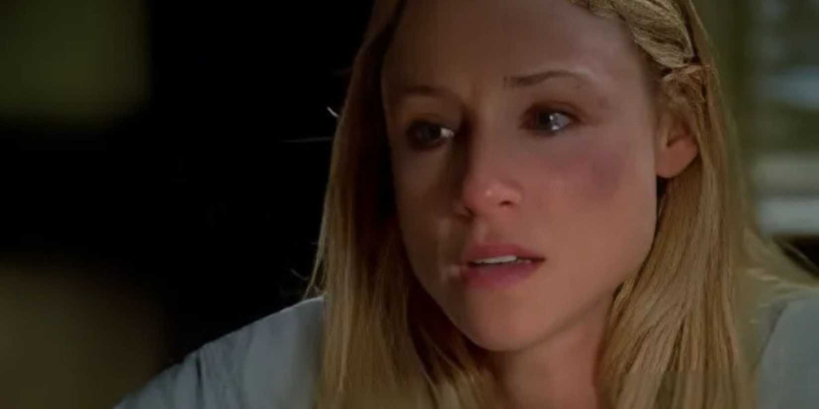 Law & Order SVU Tracy Pollan as Harper with a bruise under her eye