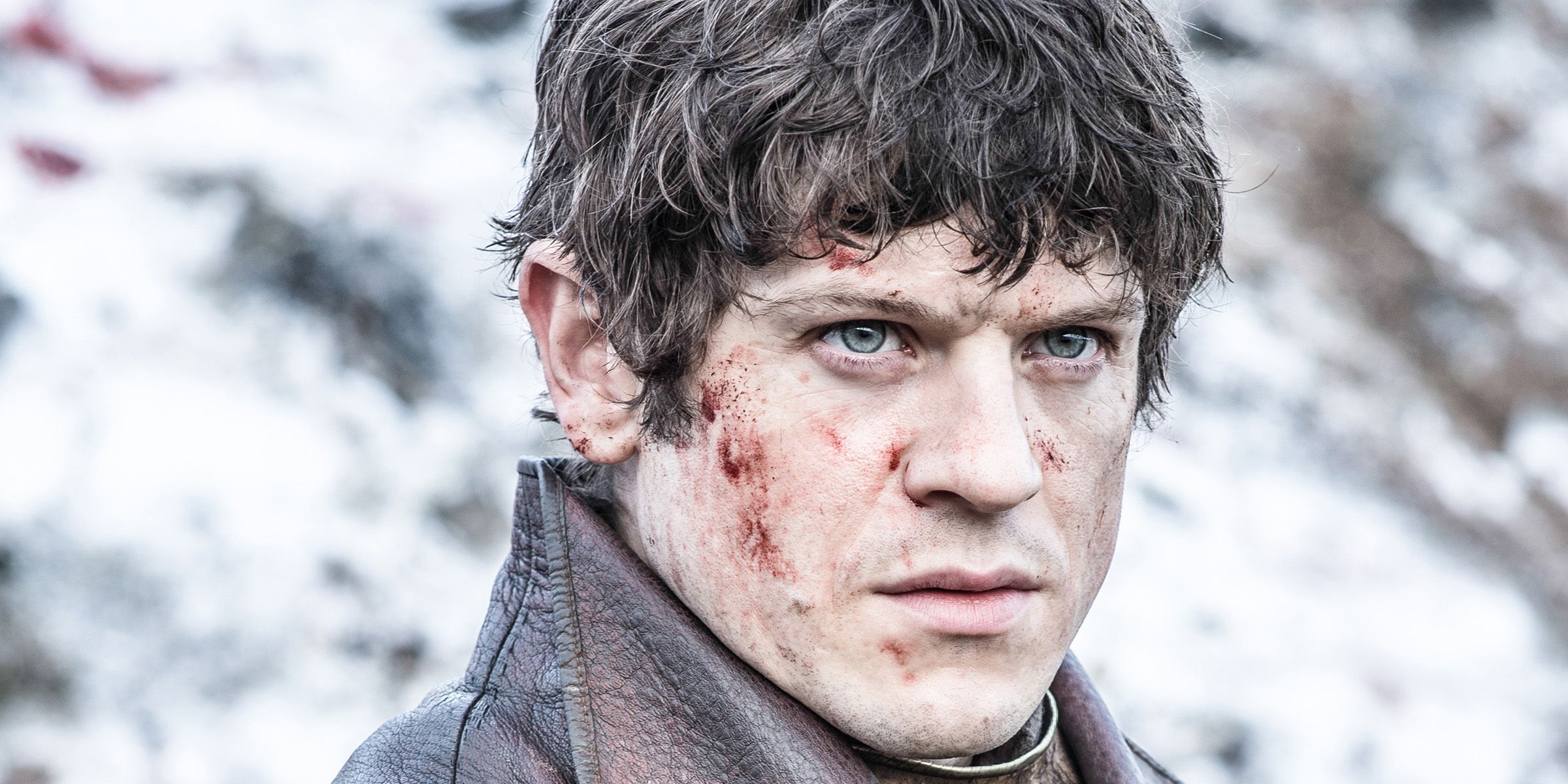Ramsay Bolton with blood on his face and a serious expression in Game of Thrones.