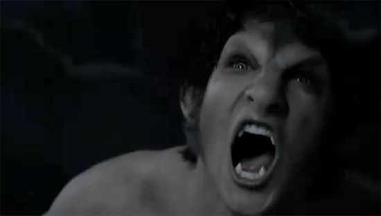 ‘Teen Wolf’ TV Show Trailer: ‘Twilight’ Style Teen Drama