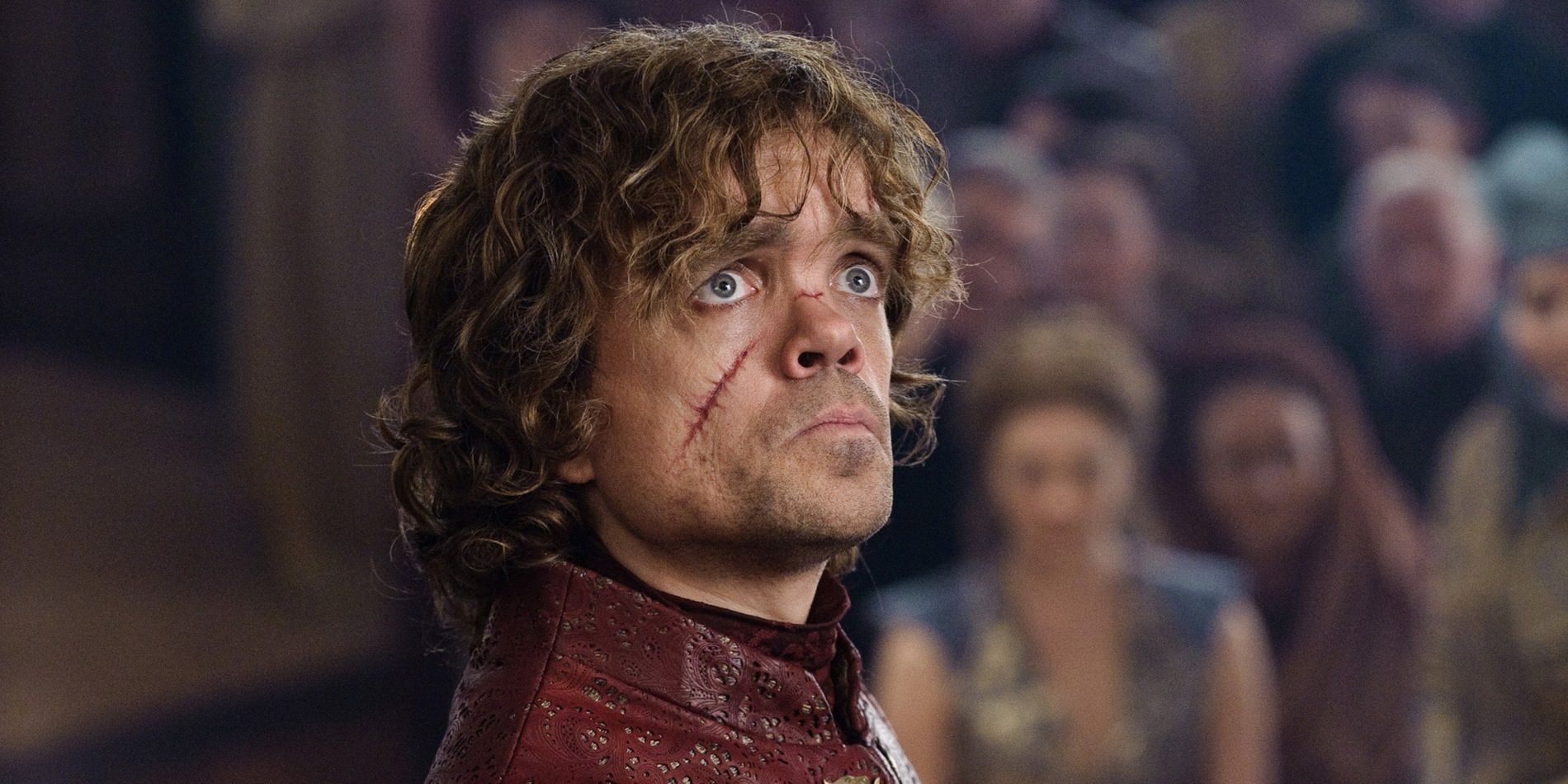 Tyrion Lannister disfigured on Game of Thrones