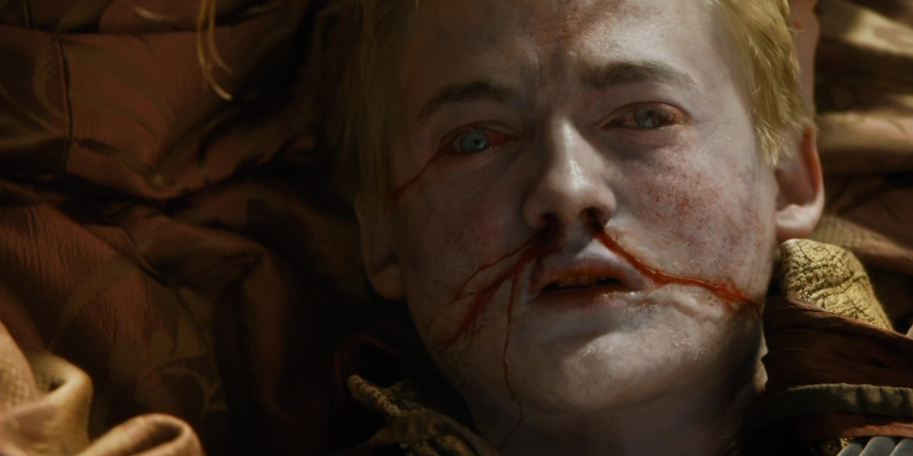 Joffrey bleeding from his nose and eyes in Game of Thrones