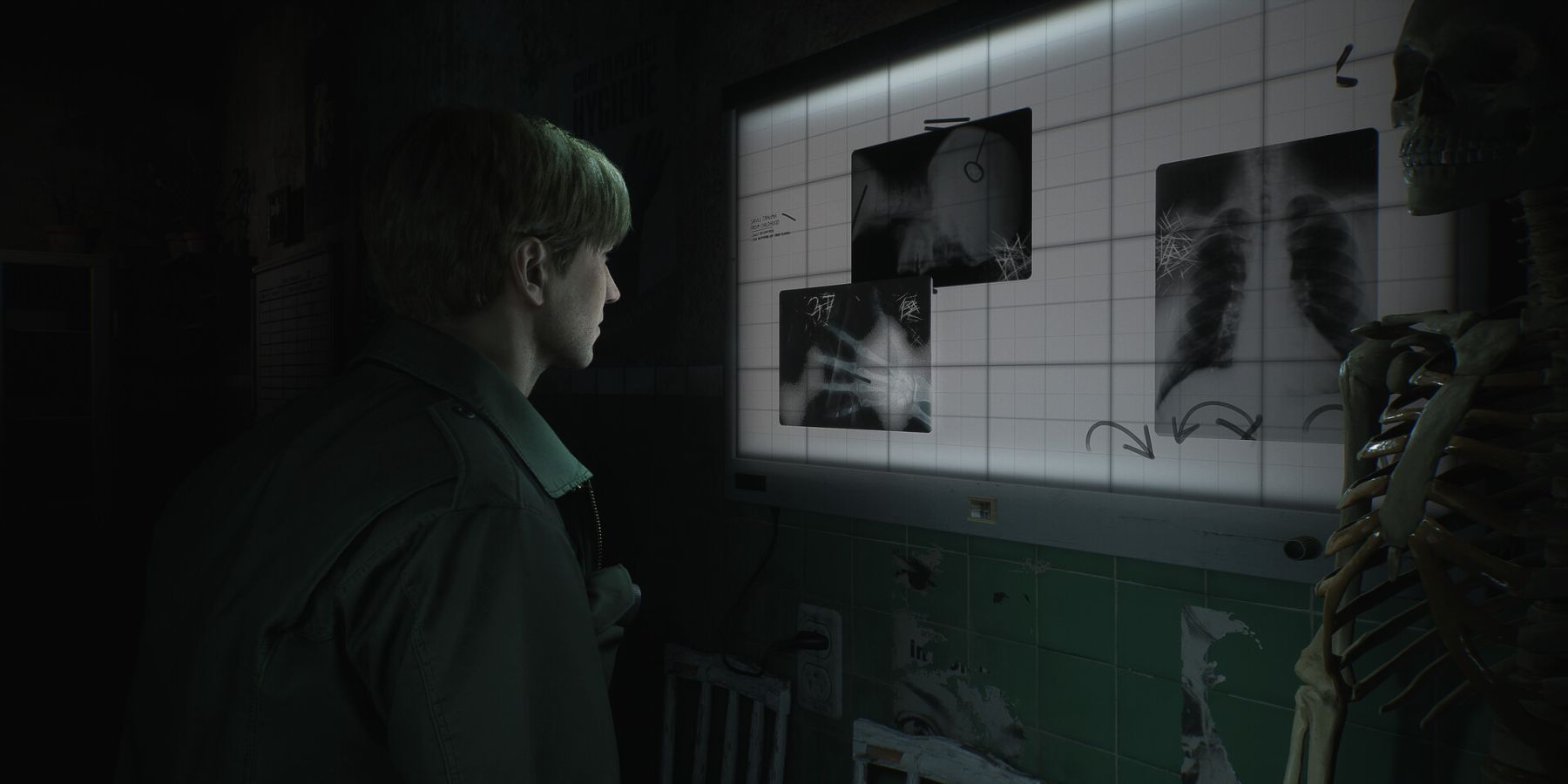 Silent Hill 2 Remake's Two New Endings Explained (In Detail) (2024)